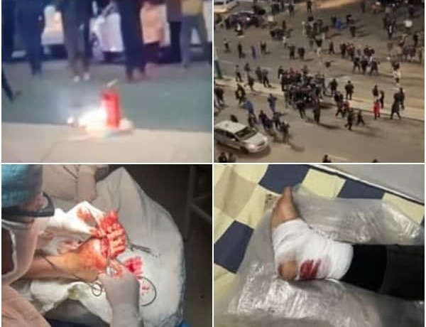 «Samarqand darvoza»da qo‘lbola o‘t o‘chirish moslamasi portladi, jarohat olganlar bor