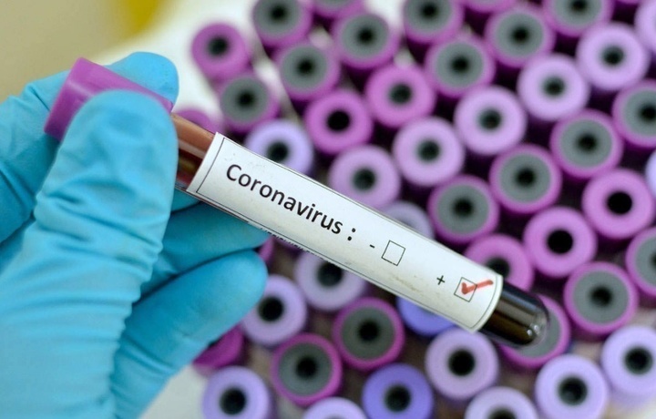 В Узбекистане число больных коронавирусом увеличилось на 32 человека