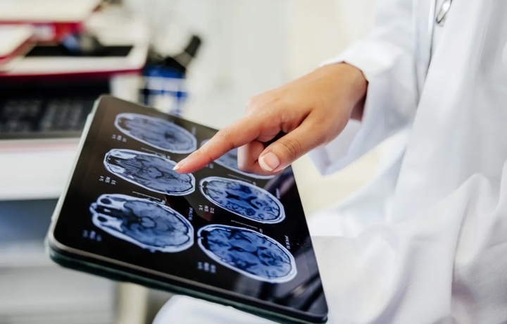 Xitoyda Neuralink chiplaridan ustun bo‘lgan miya implantini qo‘llash boshlandi