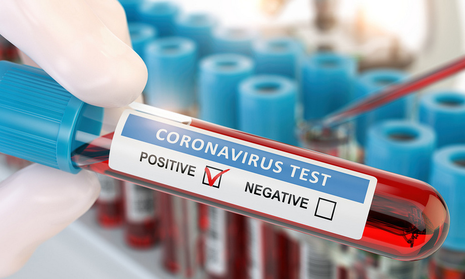 В Узбекистане за сутки выявлен 251 новый случай коронавируса