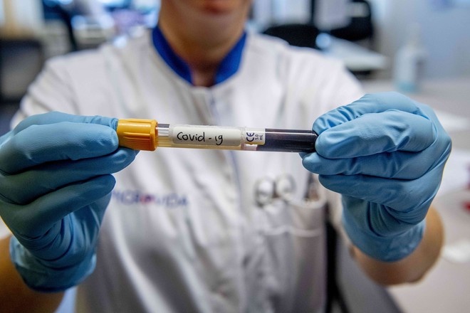 Минздрав США дал $450 млн фармкомпании Regeneron на «коктейль» от COVID-19