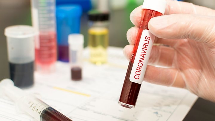 Еще у 5 человек обнаружен коронавирус. Из них 4 выявлено в Ташкенте