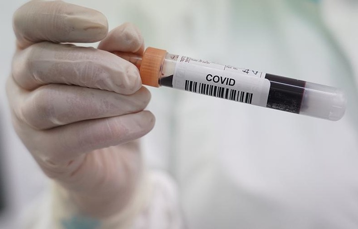 Boshqa viruslarga o‘xshamaydi: koronavirusning g‘alati xususiyati aniqlandi