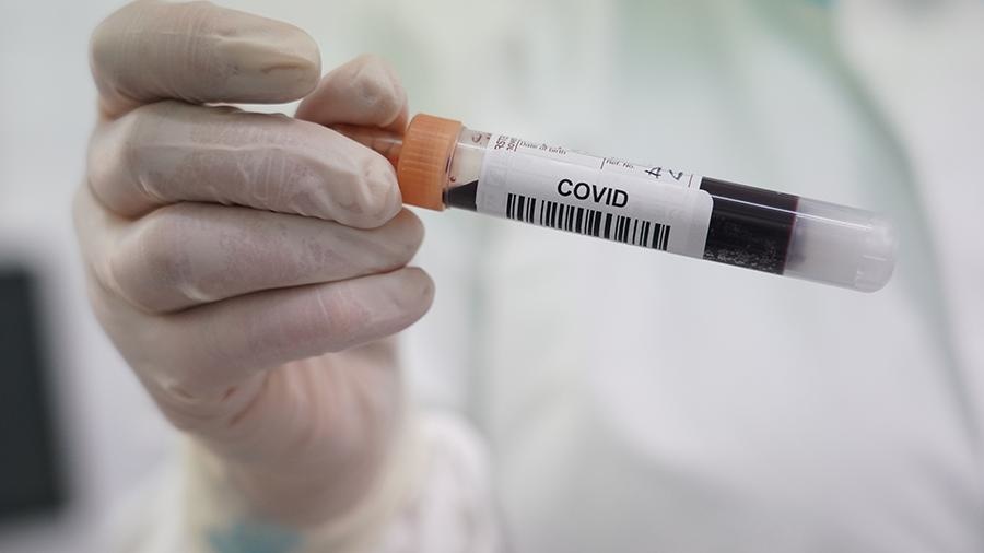 Boshqa viruslarga o‘xshamaydi: koronavirusning g‘alati xususiyati aniqlandi