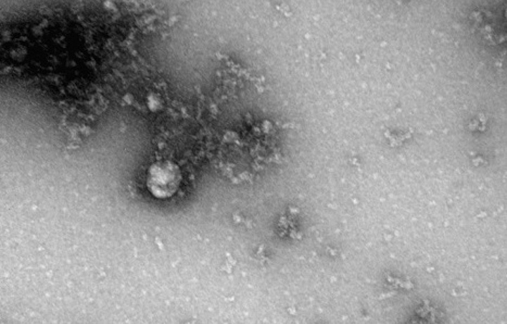 Первое изображение британского штамма коронавируса получили в России