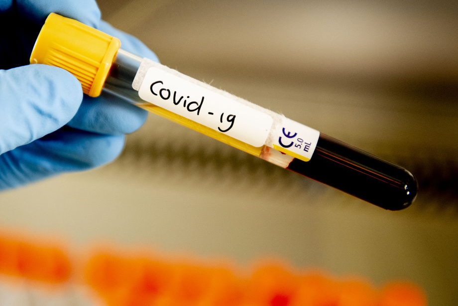 O‘zbekistonda koronavirus bemorlarining 6-7 foizi o‘ta og‘ir ahvolda