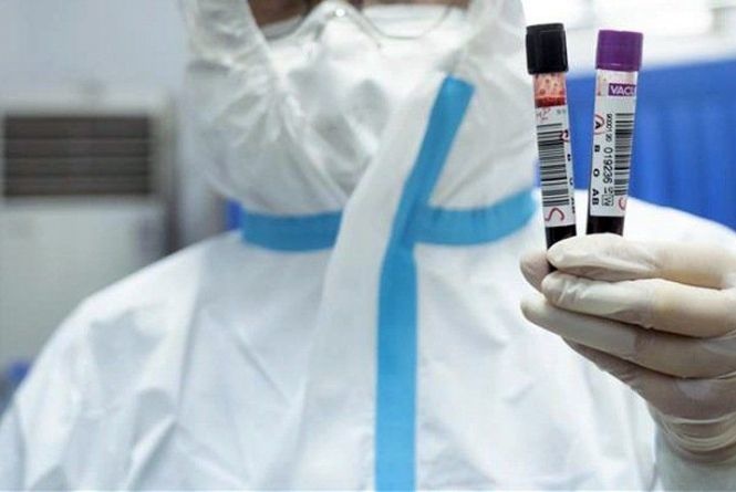 Число больных коронавирусом в Узбекистане достигло 520 человек