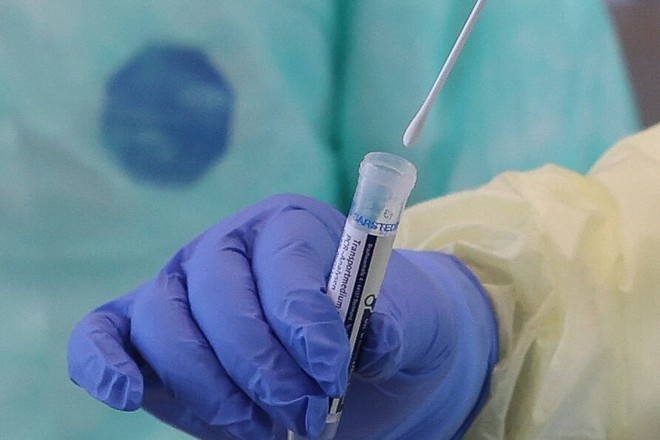 Число подтвержденных случаев коронавируса в Узбекистане достигло 263 человек
