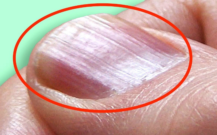 Bu belgilar kasallik alomatlari bo‘lishi mumkin