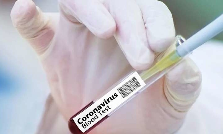 Koronavirus infeksiyasi aniqlanganlar soni oshdi